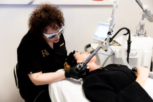 Profractional Laser at Renova Aesthetics in Carmel